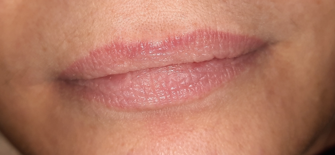 Lippenbehandlung, vorher/nachher