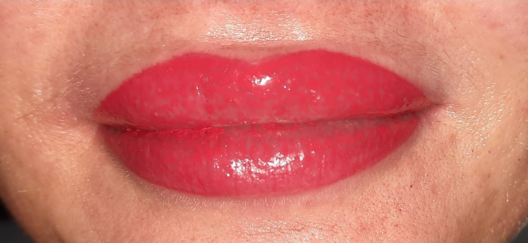 Lippenbehandlung, vorher/nachher