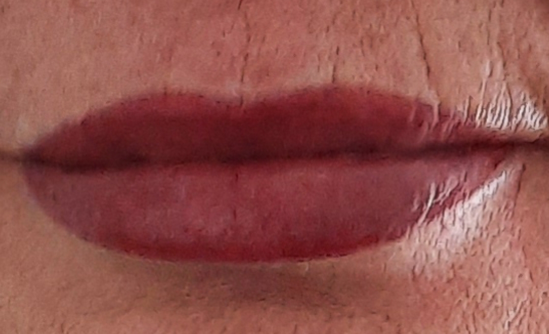 Lippenbehandlung, vorher/nachher
